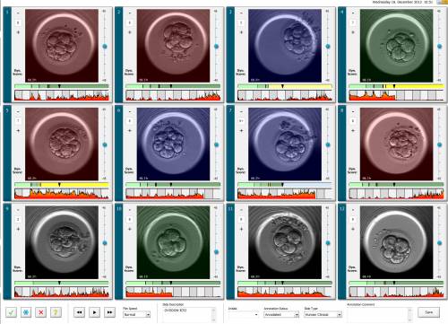 EmbryoScope