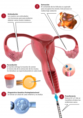 Foto CEFER Instituto de Reproducci�n
