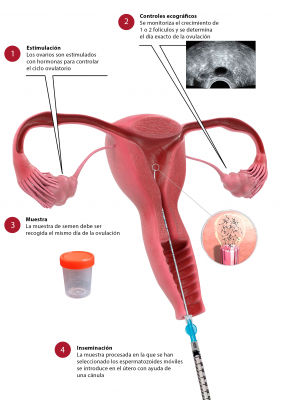 Foto CEFER Instituto de Reproducci�n