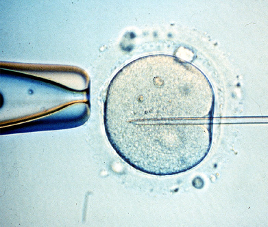 Qu� y como es la Fertilizaci�n In Vitro o FIV