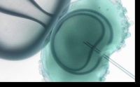 post preocupaciones de transferencia de embriones incluyendo sangrado despus de la transferencia