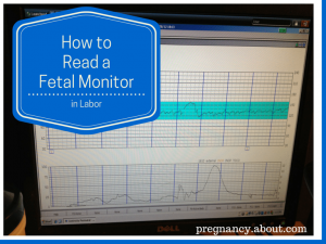 cmo leer un monitor fetal durante el parto